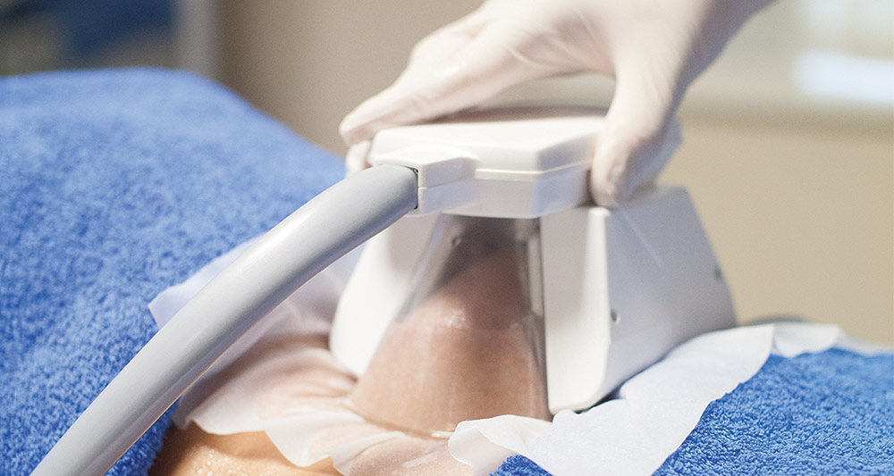 How Fat Freezing and HIFU Work Together? 2 Multiple Areas in One Session HIFU and Fat Freezing East Sussex
