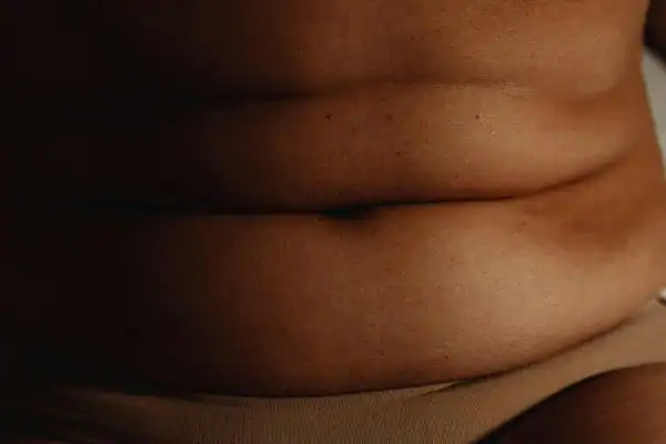 The Hidden Connection: How Stress Shapes Your Fitness and Body Composition 3 image of what stress can do on the stomach area and how Lipo 360 East Sussex can help to change your body shape.
