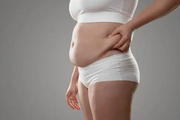 Image of stress belly  East Sussex How Lipo 360 can help manage your symptoms